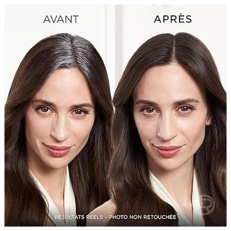 L'Oréal Paris Magic Retouch Temporary Hair Color Spray - Root Touch Up - 75ml - Brown