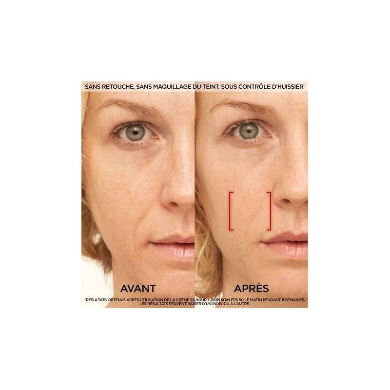 L'Oréal Paris Revitalift Laser X3 Anti-Aging Day Cream Triple Action - Mature Skin - 50ml