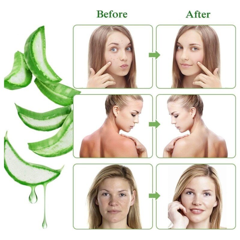 Betty'S Nature Aloe Vera Gel Cors et Visage - Peau Irritée - 300ml