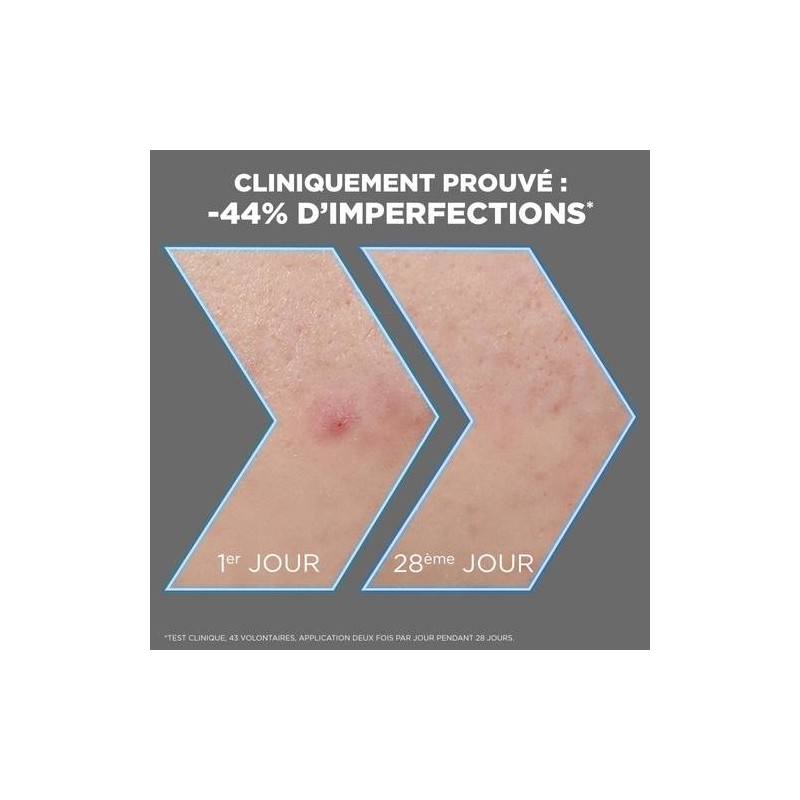 Garnier PureActive مصل الوجه المضاد للعيوب - للبشرة المعرضة لحب الشباب - 30 مل