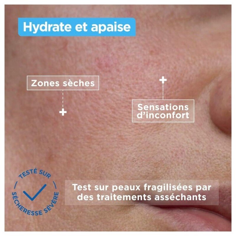 Mixa Crème Visage Anti-Sécheresse Acide Hyaluronique et Squalane - Peau Mixte - 50ml