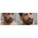 Blondépil Homme Coloration Barbe et Moustache - Brun Naturel 40